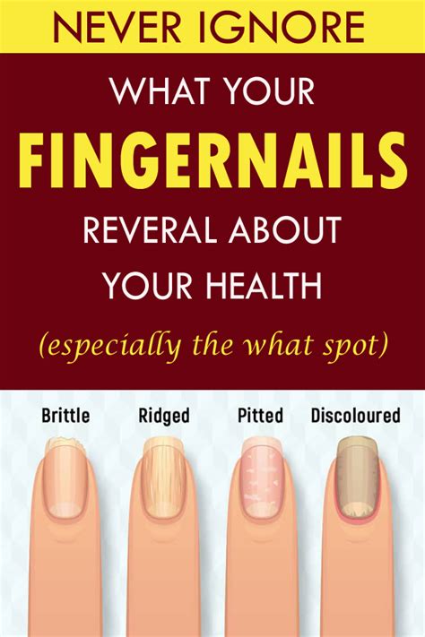 What Your Fingernails Say About Your Health