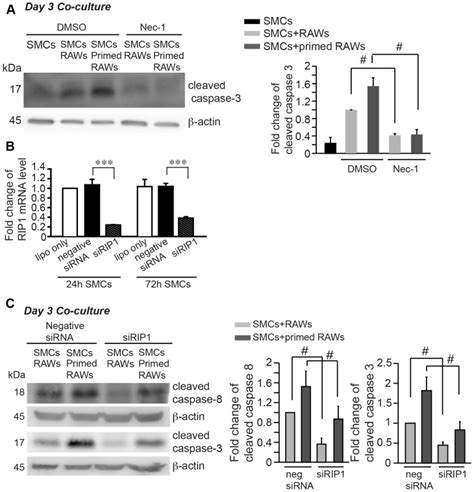 A Inhibition Of Rip1 With Necrostatin 1 Nec 1 40 μm Profoundly