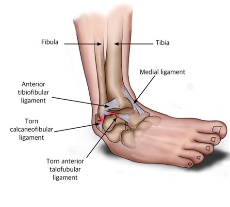 Foot Ligament Diagram