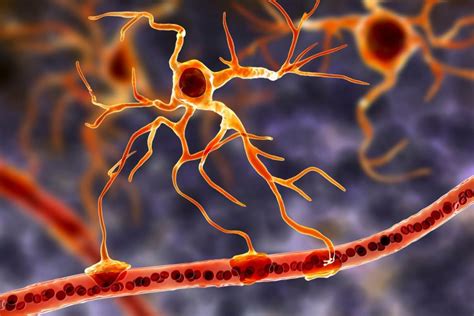 Astrocytes likely contribute to Parkinson’s disease progression