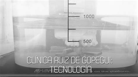 Apostamos por la mejor tecnología - Clínica Ruiz de Gopegui - YouTube