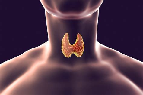 Tiroiditis De Hashimoto S Ntomas Diagn Stico Y Tratamiento