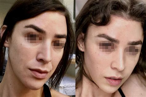 Results Of Sex Change Gender Surgeries