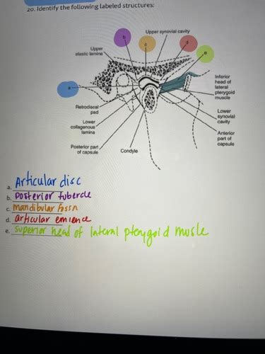 TMJ Flashcards Quizlet