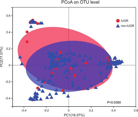 Principal Coordinates Analysis PCoA Between IUGR And Non IUGR Groups