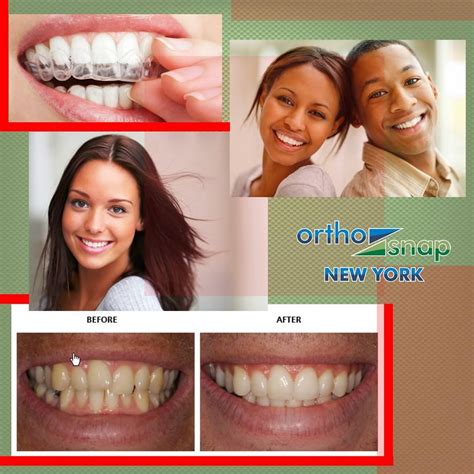 Orthosnap Is An Easy To Use And Affordable Alternative To Braces That