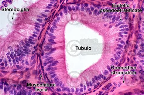 Uomo Testicolo Epididimo Sezione Trasversale X Uomo