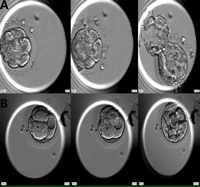 Frontiers Vacuolization In Embryos On Days And Of In Vitro