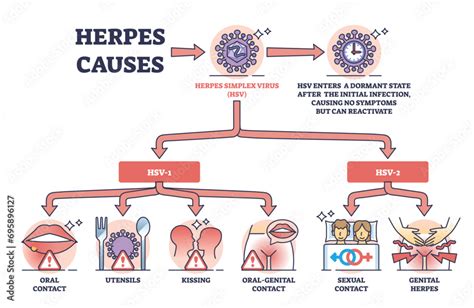 Herpes Causes And Medical Skin Hsv Virus Transmission Outline Diagram Labeled Educational List