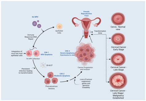 Pathogens Free Full Text Human Papilloma Virus An Unraveled Enigma