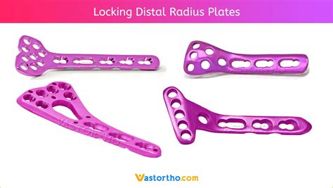 Locking Distal Radius Plates Uses And Sizes Vast Ortho