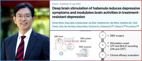 学术动态 清华大学李路明团队和301医院等合作研究发现缰核dbs有助治疗难治性抑郁症 发表在nature子刊 患者 神经