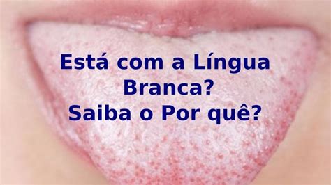 Est A Lingua Branca Saiba O Por Qu Lingua Branca Lingua