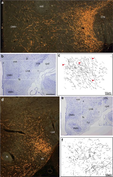 Projections From The CEAm Darkfield Photomicrograph A Illustrating