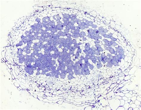 Legume-rhizobia symbiosis influences bacterial community in plant roots 