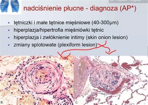 Układ oddechowy Flashcards Quizlet