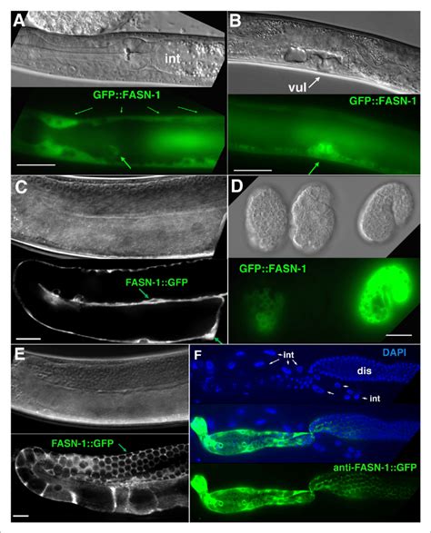 Expression Of N Terminal Gfp Fasn Or C Terminal Fasn Gfp