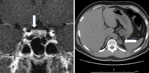 Figure A Dynamic Contrast Enhanced Magnetic Resonance Imaging Mri