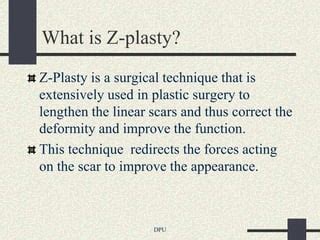 Z plasty | PPT