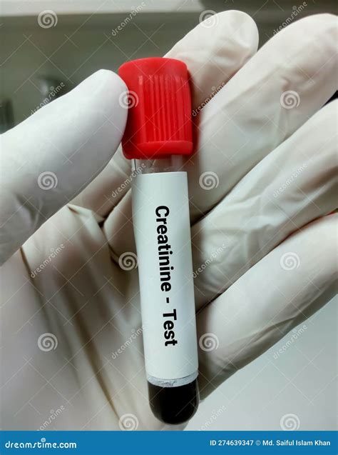 Blood Sample For Creatinine Test Diagnosis Of Kidney Or Renal Disease