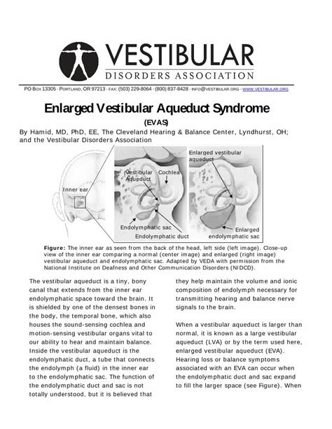 (PDF) Enlarged Vestibular Aqueduct Syndromevestibular.org/sites/default ...