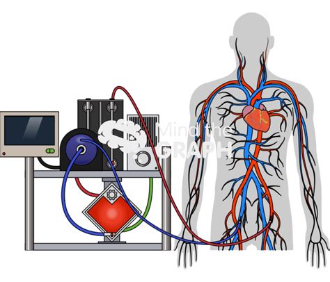 Va Ecmo Venoarterial Extracorporeal Membrane Oxygenation