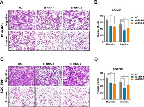 Cell Migration And Invasion In Gastric Cancer Cell Lines After