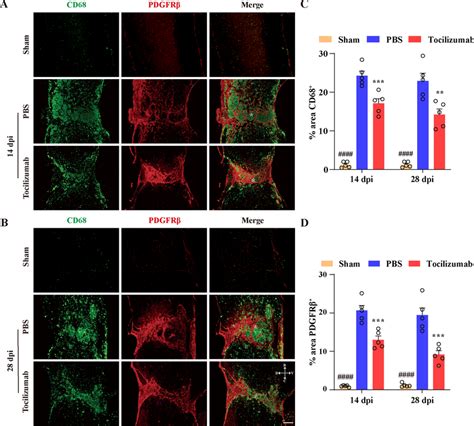 Tocilizumab Reduces Macrophagemicroglia Inflammation And The Formation