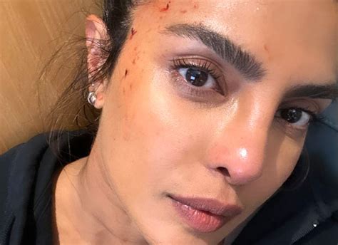 Priyanka Chopra Sustains Minor Injury On The Sets Of Heads Of State