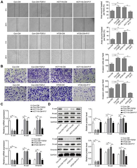 Blocking Tgfβ1 Inhibits The Migration And Invasion Of Hct116 And Ht29