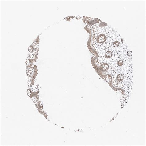 Tissue Expression Of Odc Staining In Colon The Human Protein Atlas