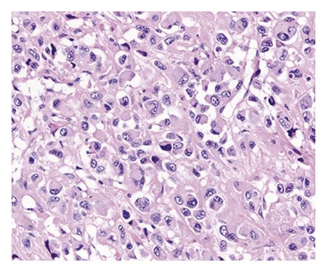 Pathological Findings At Autopsy Macroscopic Observation Of The