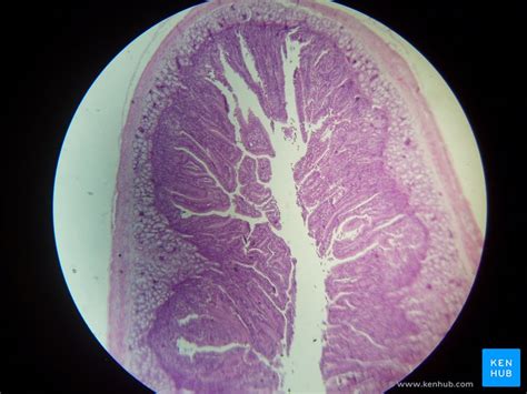 Duodenum Anatomy Histology Composition Functions Kenhub