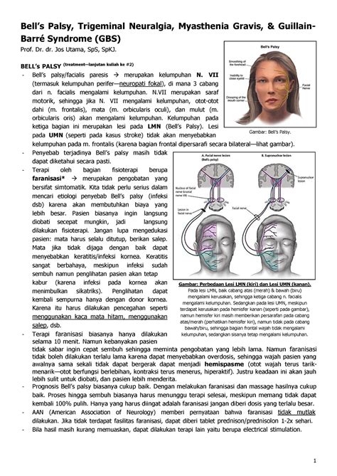 Bells Palsy Bells Palsy Trigeminal Neuralgia Myasthenia Gravis And Guillain Barré Syndrome