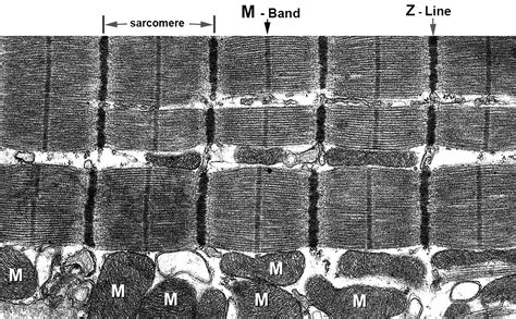 Sarcomere Histology