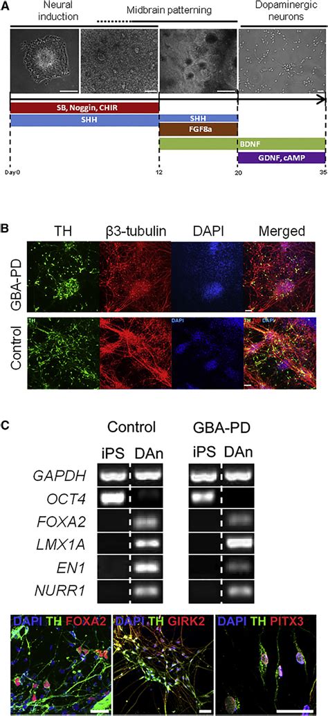 Generation And Characterization Of Ipsc Derived Dopaminergic Neuronal