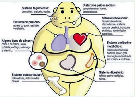 Transtornos Alimentares