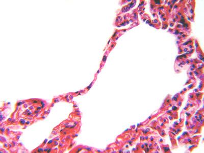 Lung Histology - Lung - histology slide