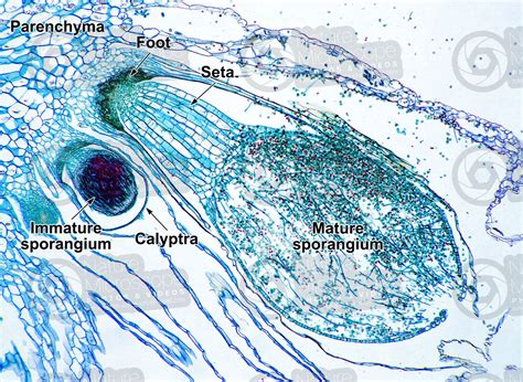 Marchantia Sporophyte