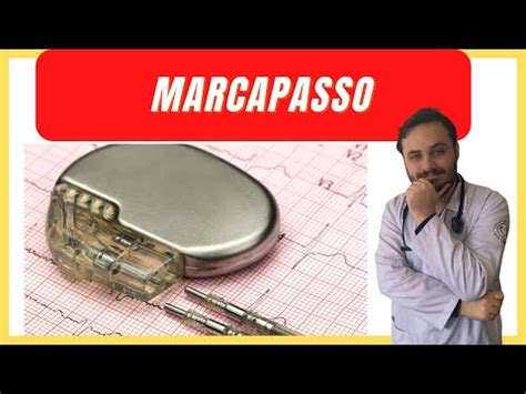 O QUE É MARCAPASSO CARDÍACO COMO É A CIRURGIA TUDO QUE PRECISA SABER