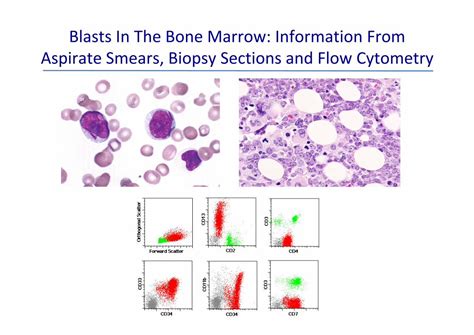 Pdf Blasts In The Bone Marrow Information From Smears And Flowsh