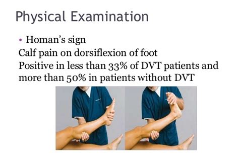 10 Deep Vein Thrombosis Dvt Facts Thrombocytes