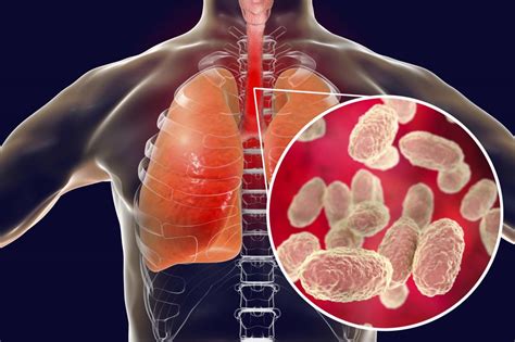 Bordetella Pertussis: Understanding the Characteristics, Transmission, and Prevention of ...