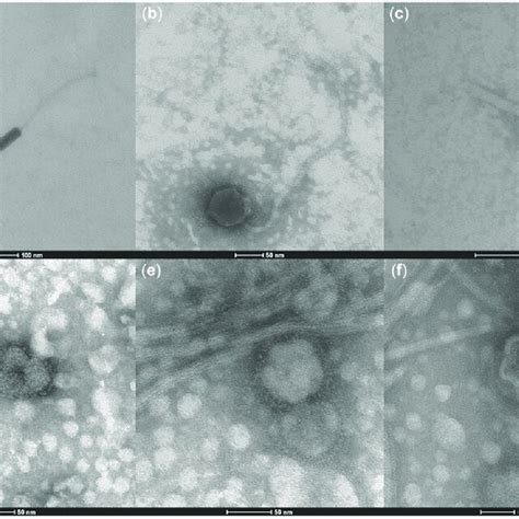 Transmission Electron Micrographs Tem Of Purified Vlps From Murine