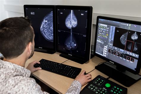 Solution D Intelligence Artificielle En Mammographie Breast Slimview