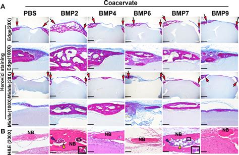 Histology Of The Newly Regenerated Bone In The Different Bmp Groups