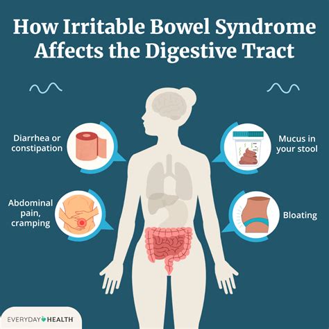 Ibs Bloating