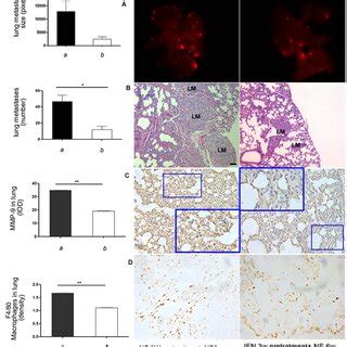 Pretreatment With Ifn A Inhibited Experimental Lung Metastasis After