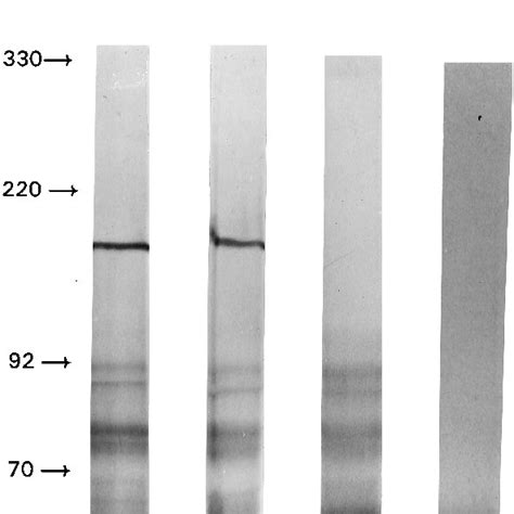 Sds Polyacrylamide Gel Electrophoresis Of In Vitro Translated And Download Scientific