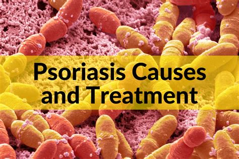 Psoriasis Causes and Treatment: A Functional Medicine Approach